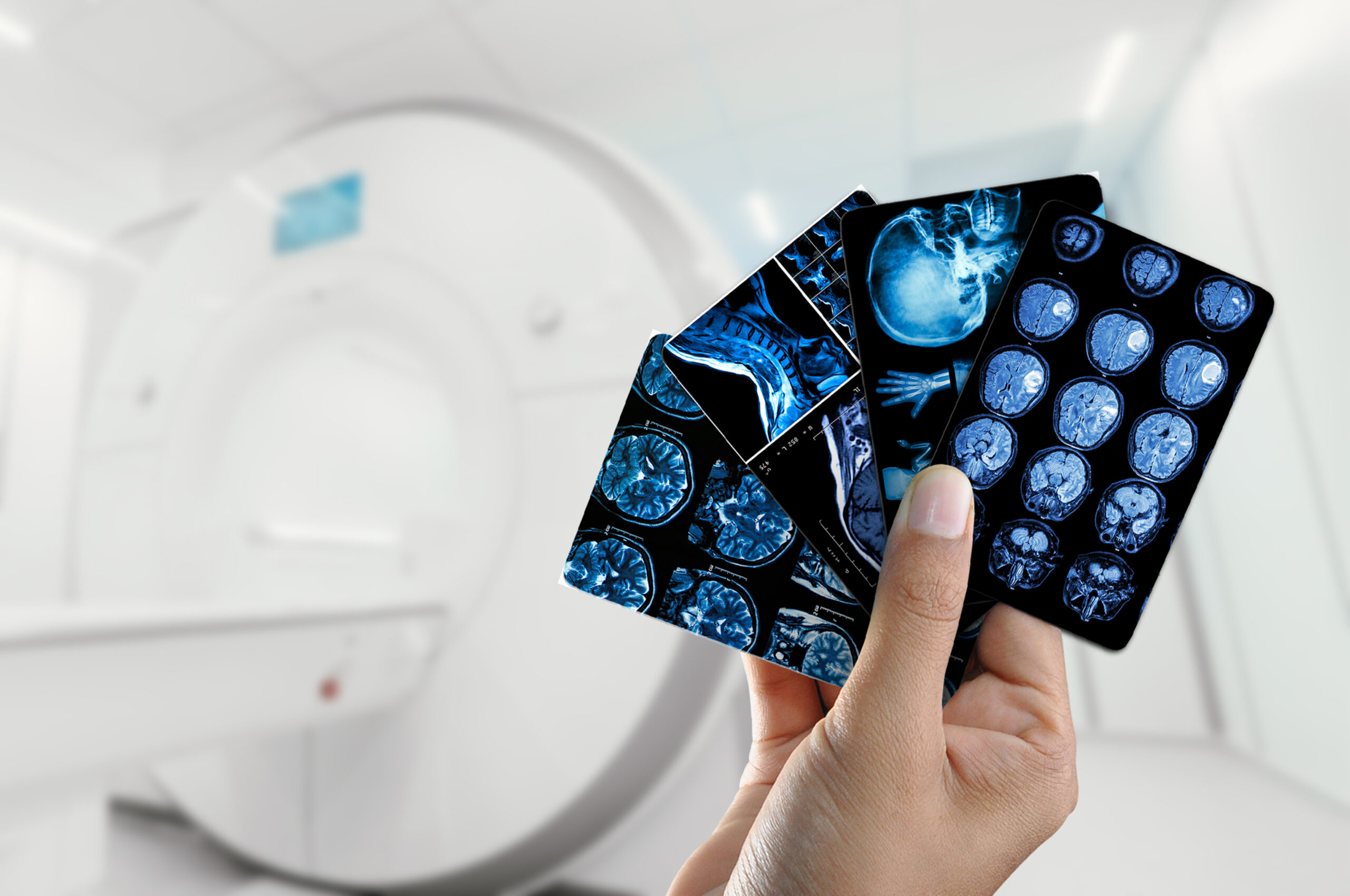 Expert MRI, Sremska Mitrovica: Magnetna rezonanca svih regija tela po sniženoj ceni